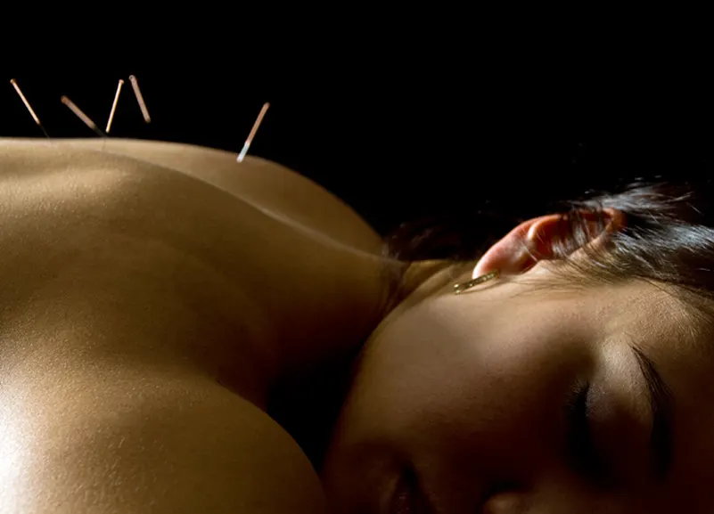 ACUPUNCTURE & REFLEXOLOGY